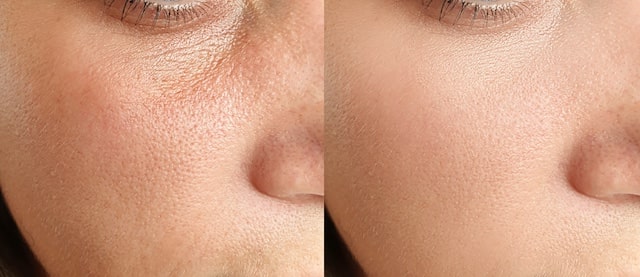 アンチエイジングの効果